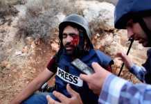 Παγκόσμια αλληλεγγύη στον παλαιστίνιο φωτογράφο που πυροβολήθηκε στο μάτι