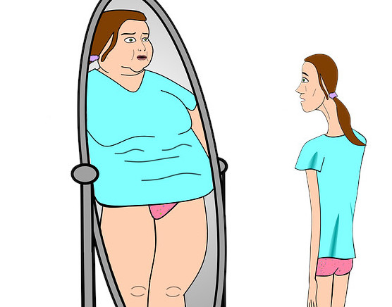 anorexia