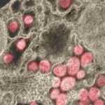 Κορονοϊός: Ανοιχτό το ενδεχόμενο να μεταδίδεται με ερωτική επαφή