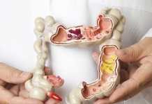 Ας μιλήσουμε για… κολονοσκόπηση