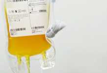 Σε 16 ασθενείς από COVID-19 στην Ελλάδα έχει χορηγηθεί πλάσμα ιαθέντων