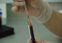 ΠΟΕΔΗΝ: Κίνδυνος για ασθενείς με μεσογειακή αναιμία – Αναβάλλονται μεταγγίσεις