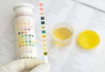 Μήπως τα ούρα σας είναι θολά;