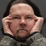 ΗΠΑ: Για πρώτη φορά επιτυχημένη τριπλή μεταμόσχευση προσώπου και χεριών (video)