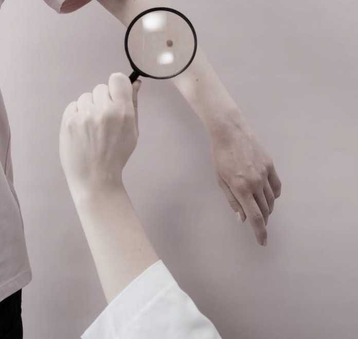 melanoma dermatologist 14-01-22