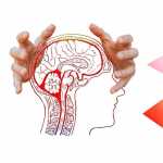 Εγκρίθηκε το Εθνικό Σχέδιο αντιμετώπισης Εγκεφαλικών επεισοδίων